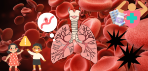 「特発性肺ヘモジデローシス」とはどんな病気？ 東京田園調布駅前呼吸器内科・内科クリニック